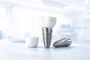Ambarlı All on Four implant